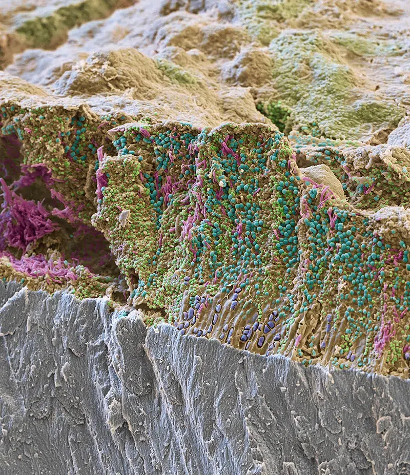 Clinica Dentária - BMQ Clinic | Guided Biofilm Therapy | 6621eb75a070b7b7102363a5 654cc62544a376348d0b8443 MicrosoftTeams image