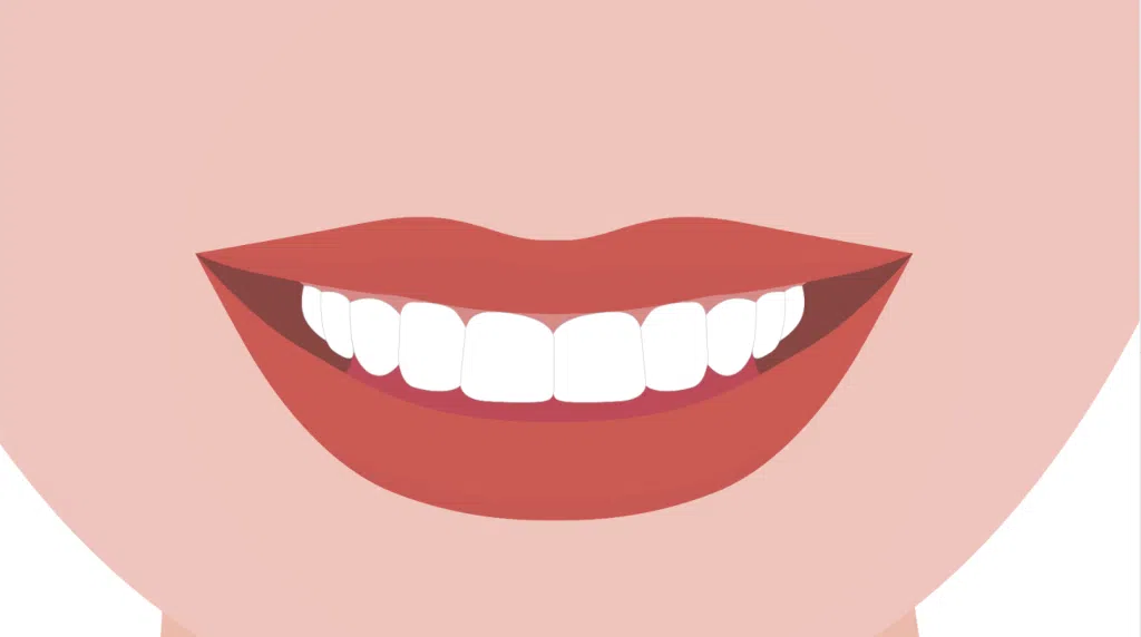 Clinica Dentária - BMQ Clinic | Guided Biofilm Therapy | gbt passo 7